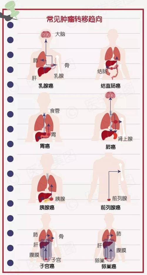 慢性压力助长癌症转移原因找到
