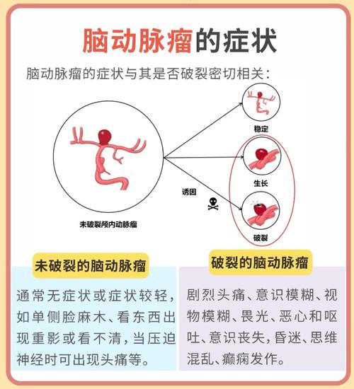 82岁老人头痛晕倒 竟是因为脑动脉瘤破裂